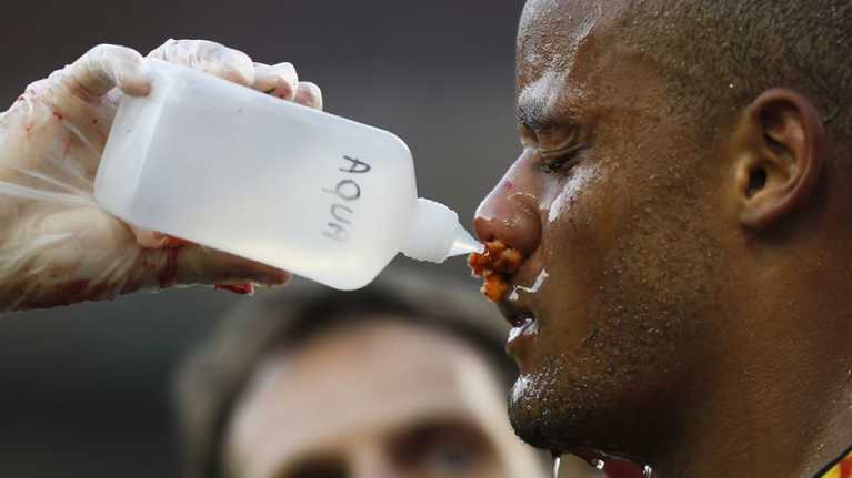 Belgian Vincent Kompany saa vettä loukkaantuneille kasvoilleen.