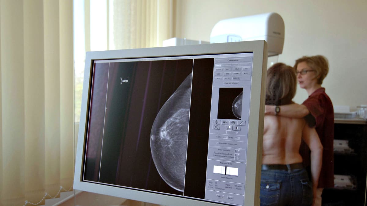 Mammografiakuvaus.
