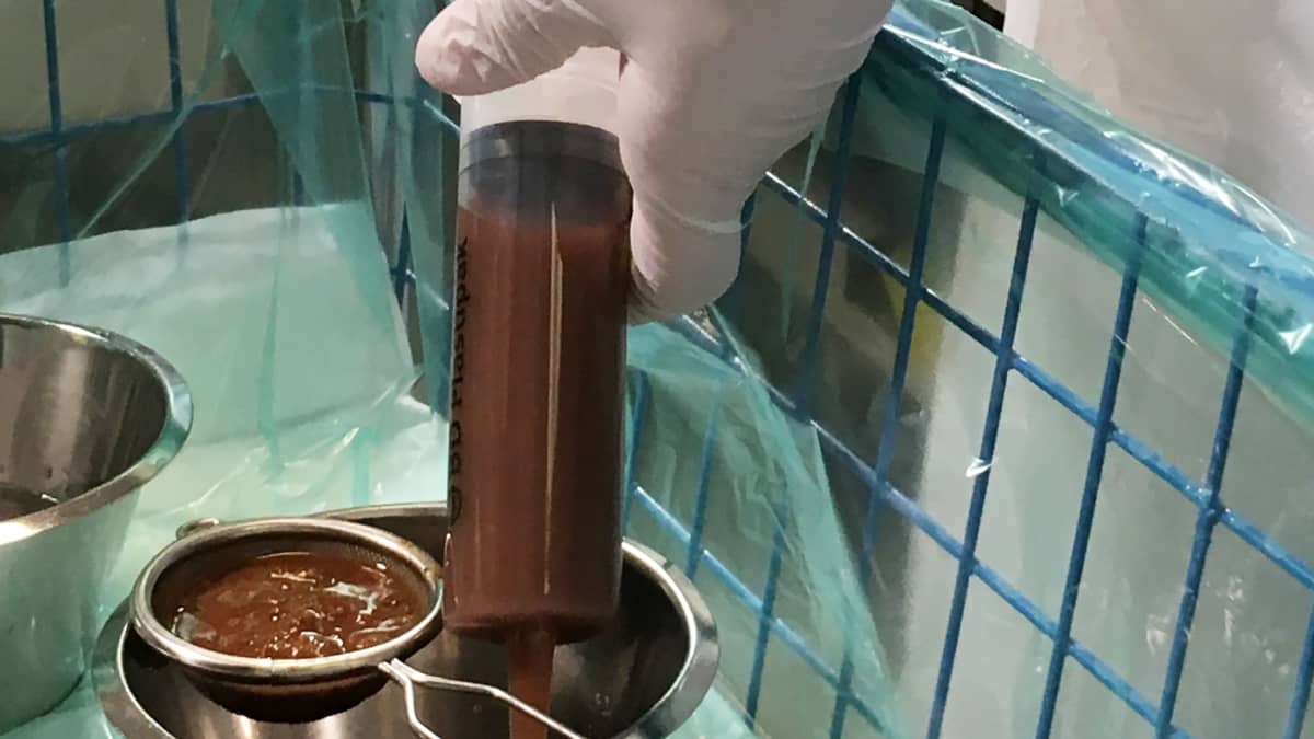 Ulostesiirre toteutetaan erikoissairaanhoidossa.
