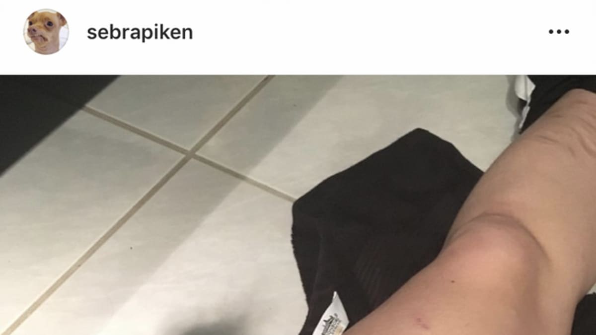 Andrinen Instaan postaama kuva, jossa näkyy viiltoja hänen reidessään.