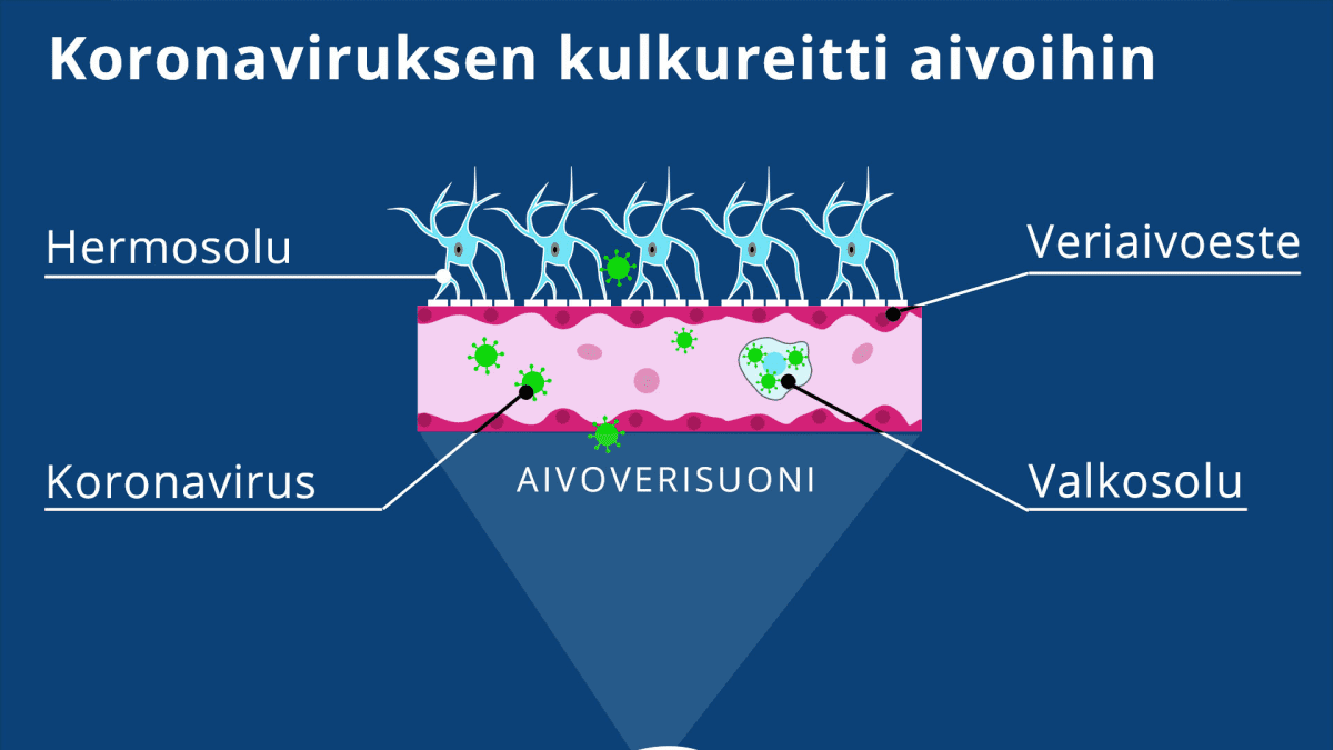 Viruksen reitit aivoverenkiertoon.