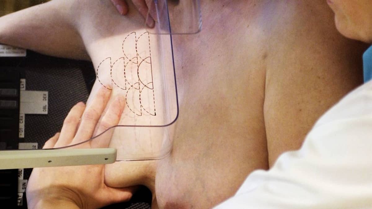 Nainen mammografiassa.