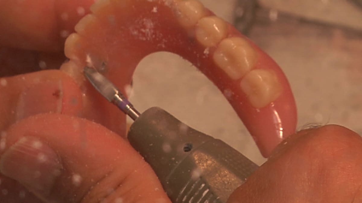 hammasproteesia korjataan