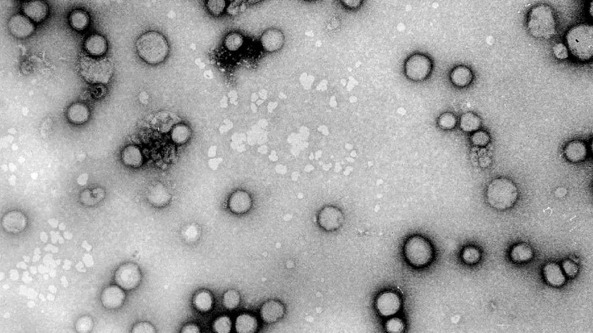 Mutations may be weakening flu jab protection | Yle
