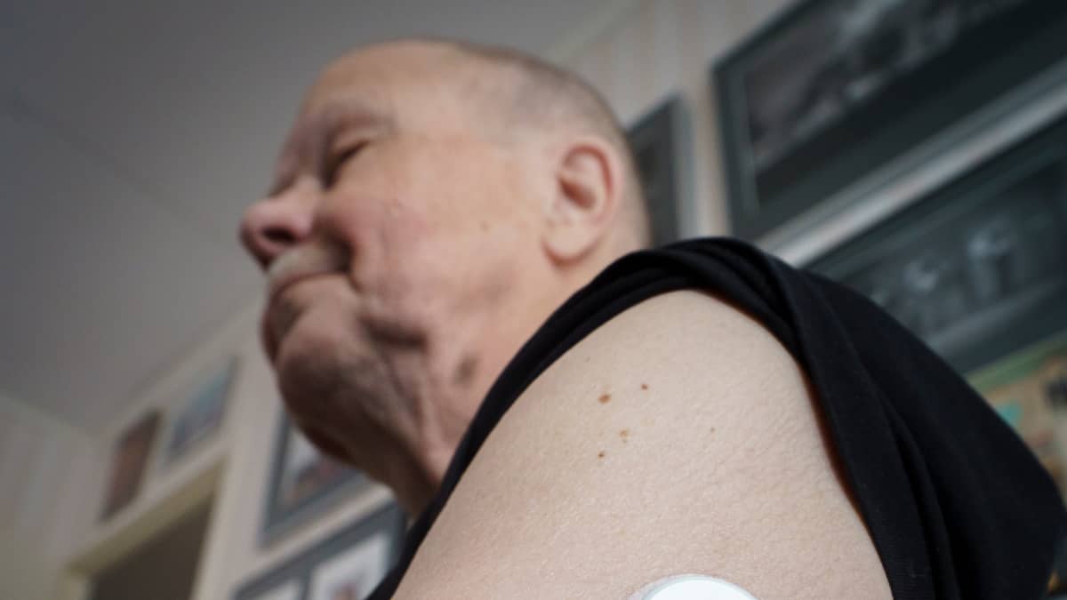 Diabetessensori  mieshenkilön olkavarressa.