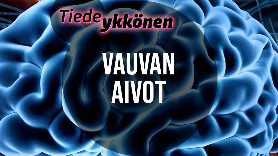 Vauvan aivot | Yle Areena – podcastit