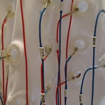 Tiedeykkönen: Aivot ja musiikki - "Musiikin kuuntelu on monipuolinen piristysruiske aivoille"