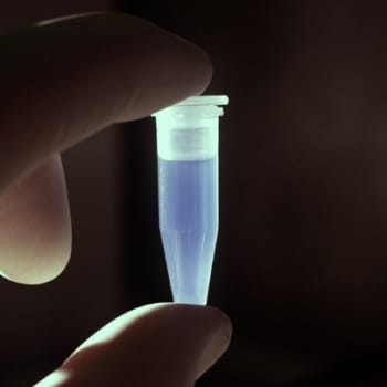 Merkittävimmät Alzheimerin taudin riskigeenit löydetty?