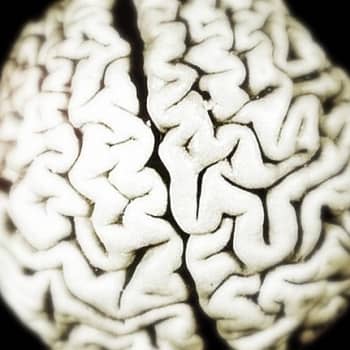 Voiko aivojen toimintaa buustata?