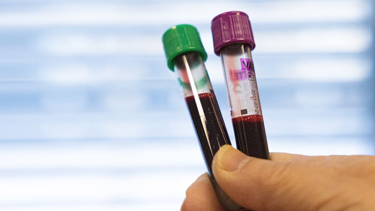 Laborantilla kädessä kaksi koeputkea täynnä verta.