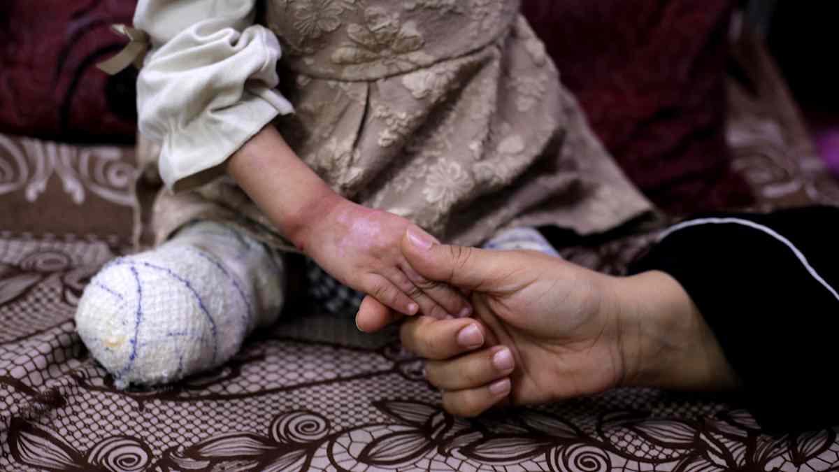 P&aring; bilden syns en liten flicka fr&aring;n midjan och ner&aring;t, hon &auml;r ikl&auml;dd en kl&auml;nning och under den syns bandagerade benstumpar. Hon h&aring;ller sin mammas hand.