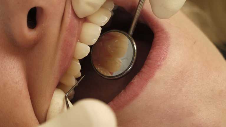 Sweets make holes in the teeth. Image: Medicimage / AOP