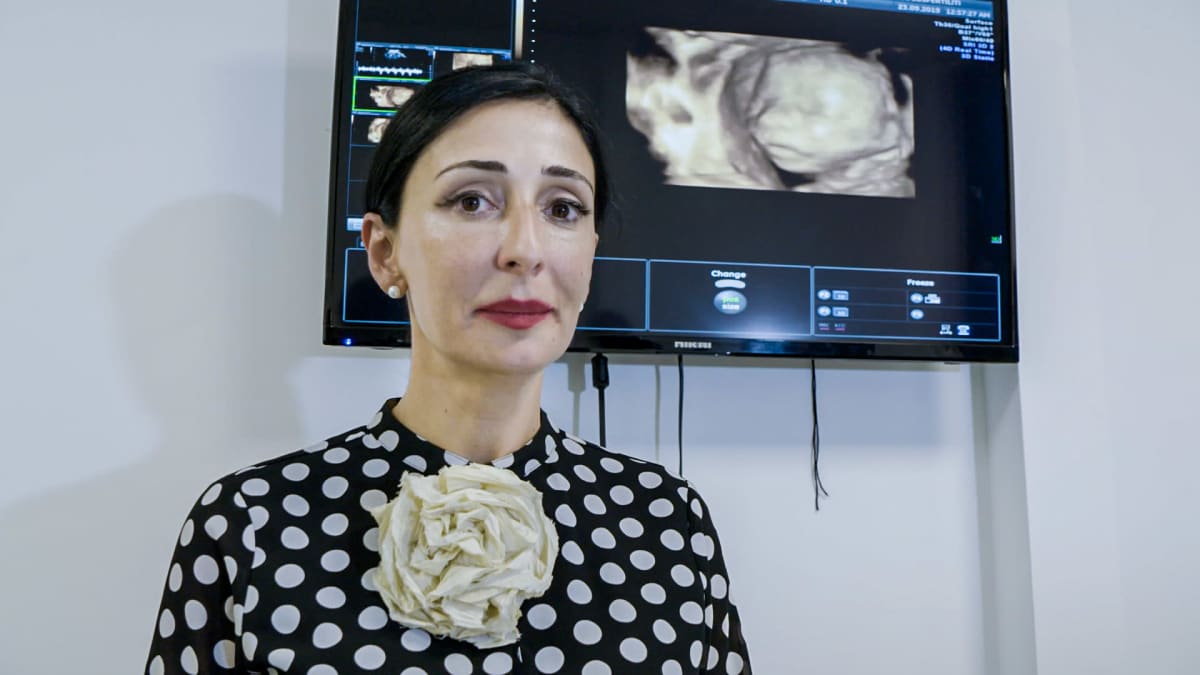 Nainen seisoo ultraäänimonitorin edessä sikiön kuva taustalla.