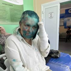 Jelena Milašina istuu sairaalasängyllä ja puhuu puhelimessa. Hänen käsi on paketissa. Naama ja vaatteet ovat turkoosin värin peitossa. Naamassa on ruhjeita.