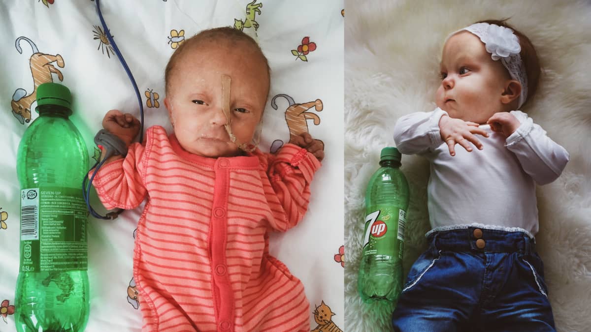 Hilda Tolonen vastasyntyneena juomapullon vieressä ja vuoden kuluttua suurempana saman juomapullon vieressä.