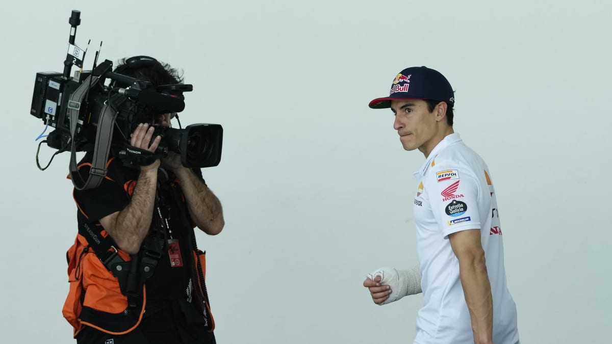 Marc Marquez kipsi kädessään