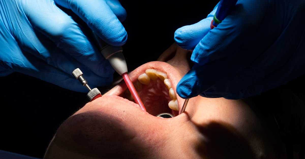 Satakunnan hyvinvointialue suunnittelee merkittävää hammashoidon keskittämistä – kymmenen hammashoitolaa suljettaisiin