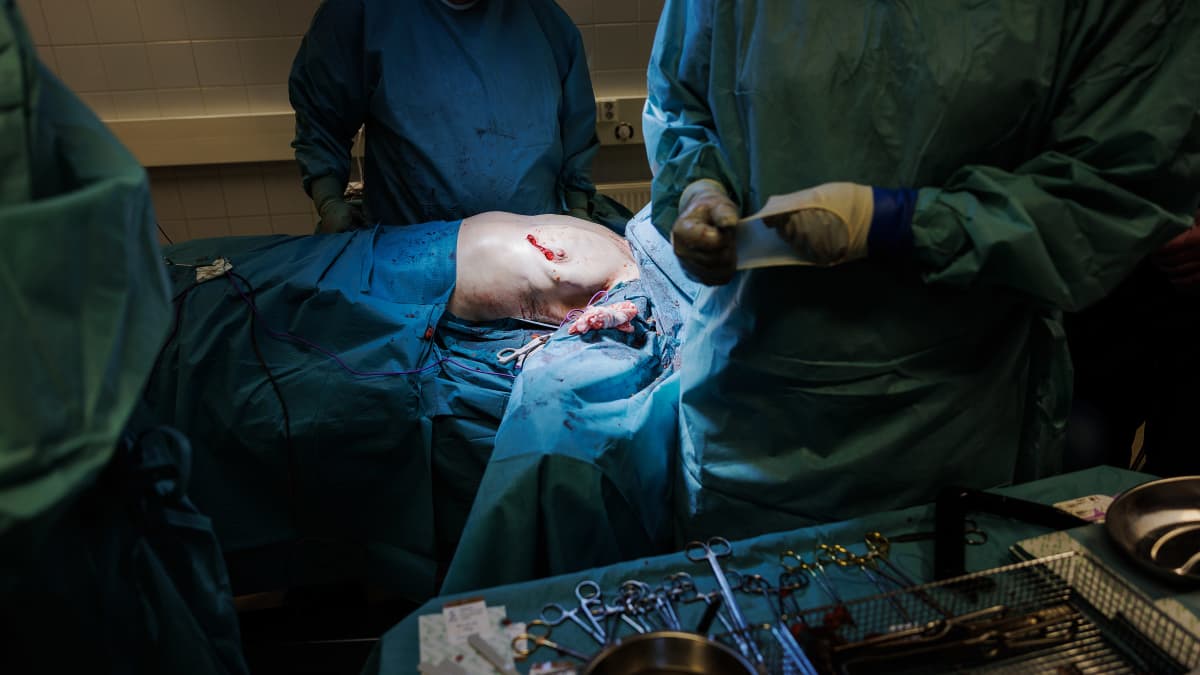 Kirurgi suorittaa tiiminsä kanssa rintaleikkausta Suomessa maaliskuussa 2023.