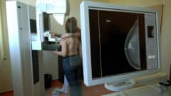 Mammografiundersökning i Berlin 2007