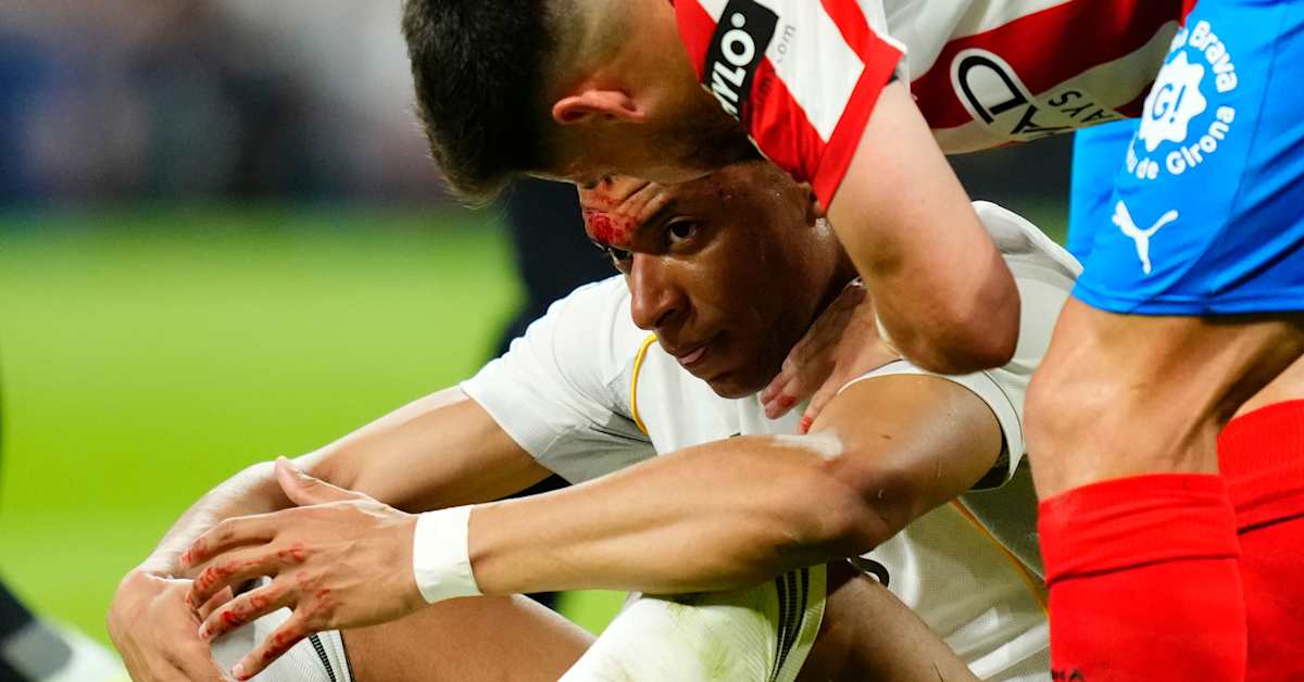 Real Madridille taas raskas pettymys – päävalmentaja tuohtui erotuomarille, kun Kylian Mbappén pää vuoti verta