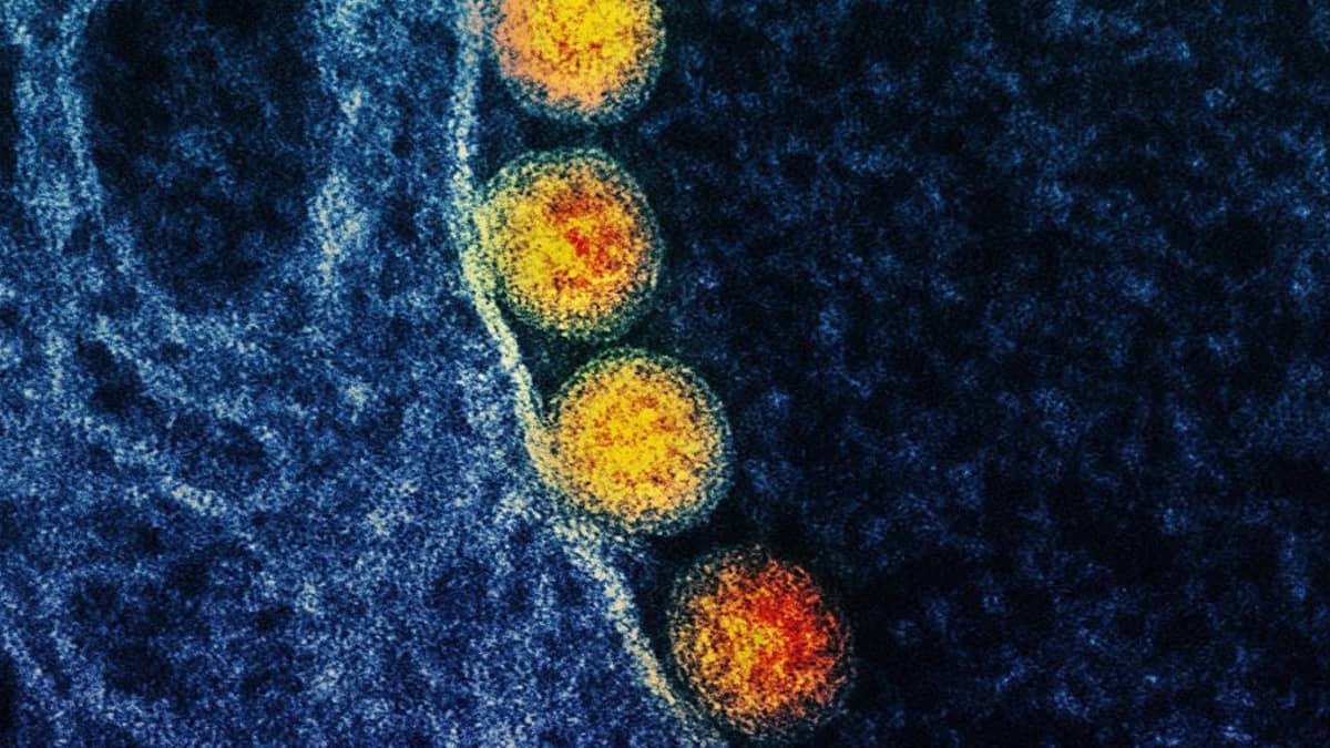 Mikroskooppikuva viidestä keltaiseksi värjätystä pyöreästä viruksesta siniseksi värjätyllä limakalvolla.