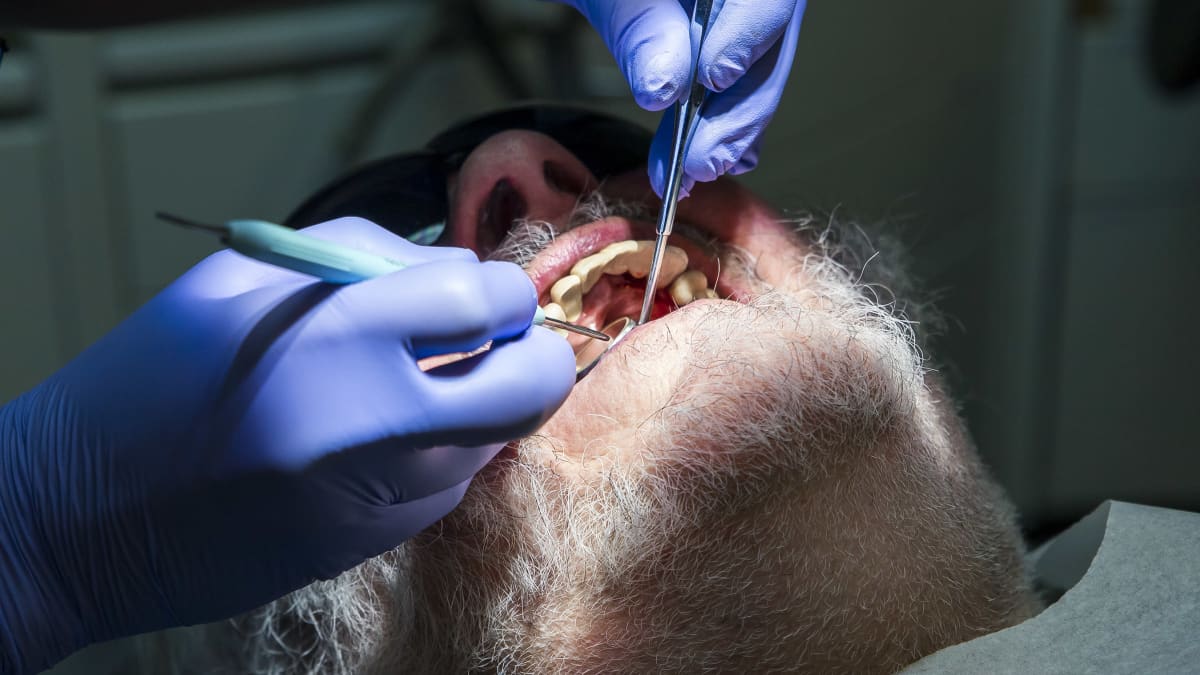 Hammaslääkäri tutkii istrumenteillä potilaan hampaita.