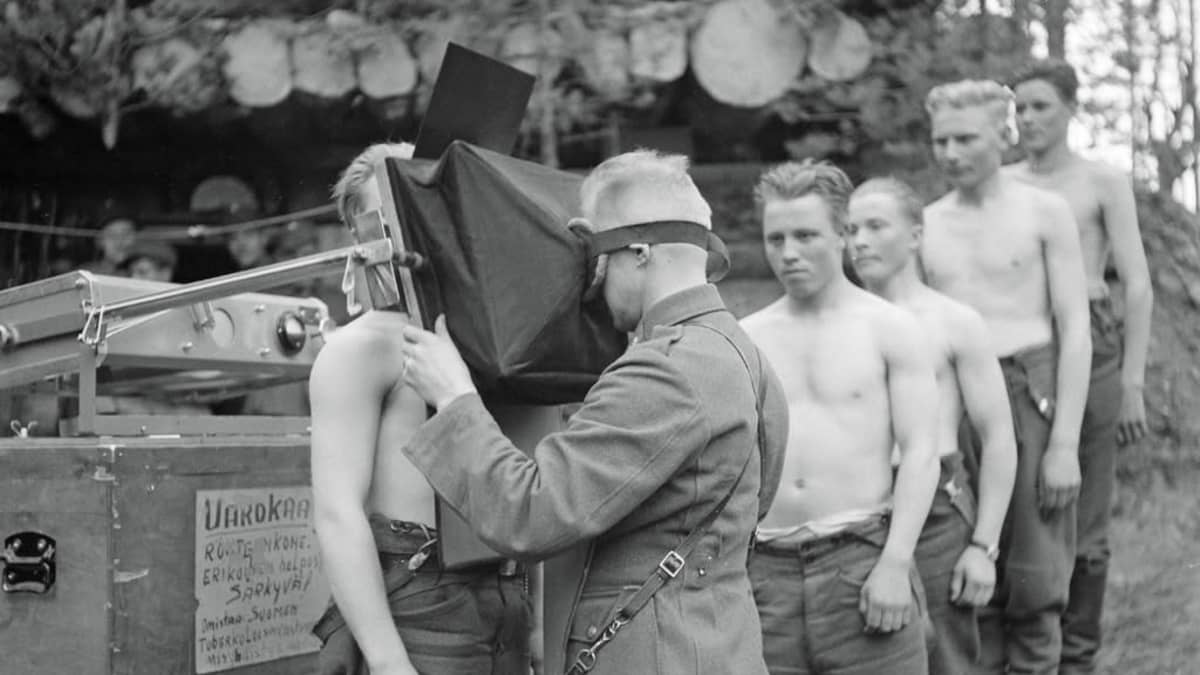 Mustavalkoinen kuva nuorista paitansa riisuneista miehistä jonossa. Ensimmäinen on sotilaspukuisen miehen tutkittavana röntgenlaitteen takana.