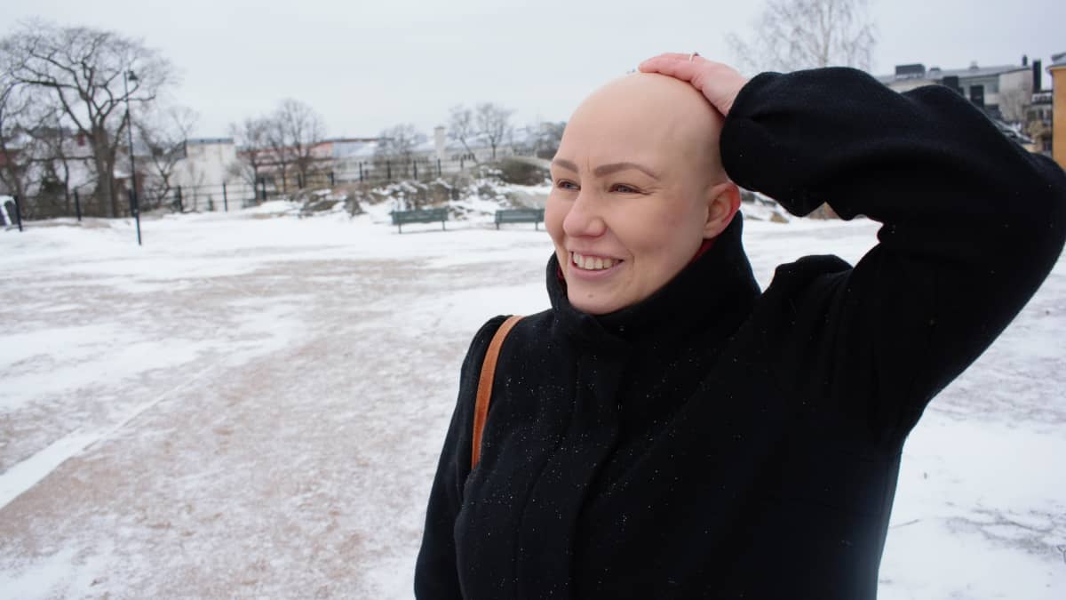 Tutkija Johanna Latva menetti hiuksensa sairauden vuoksi. 