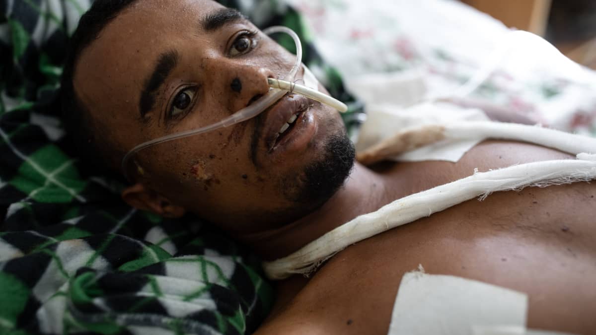 Etiopialaiset ampuivat hänet teloitustyylissä suoraan suuhun.