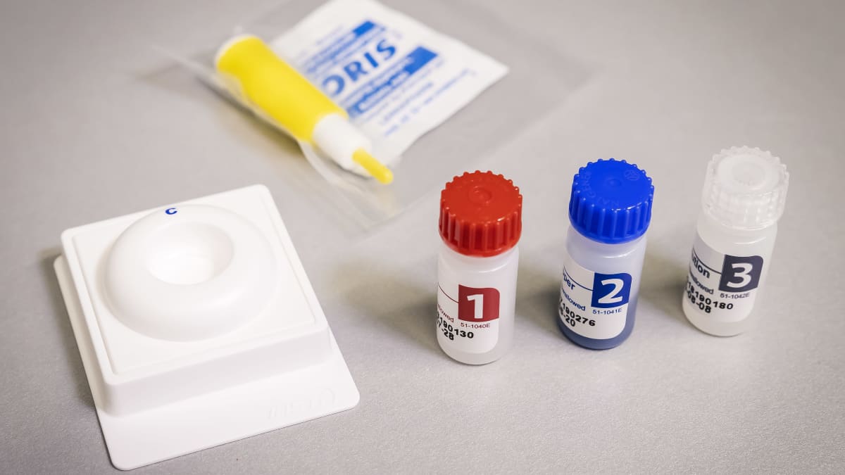 HIV-testipakkauksen sisältö pöydällä.