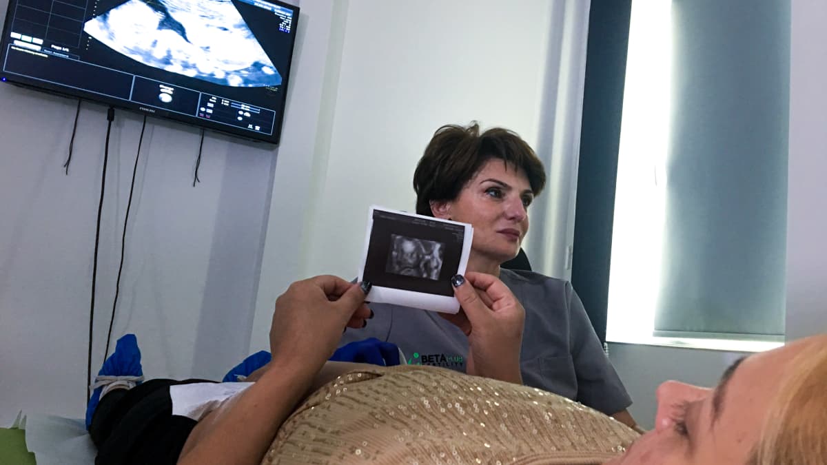 Raskaana oleva nainen katselee ultraäänikuvaa sikiöstään.