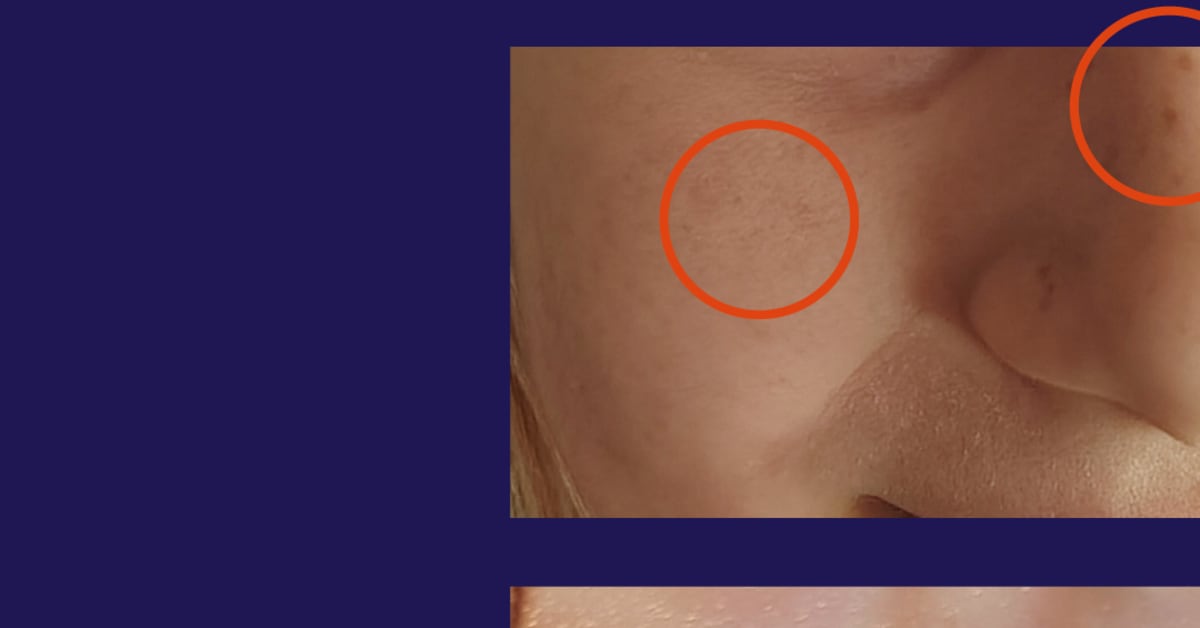 Tekoälyparannetut koulukuvat – Äiti harmittelee muutosta | Kotimaa