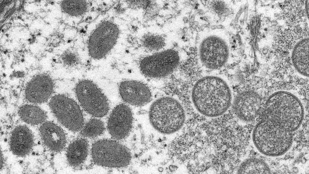 Mikroskooppi kuvaa apinarokko viruksesta.