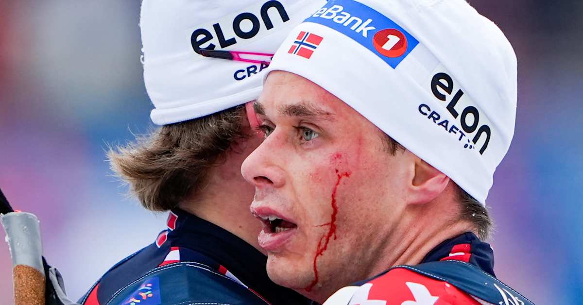 Norwegian men emotional and bloody - Jasmi Joensuu understood the pain and praised the touching moment