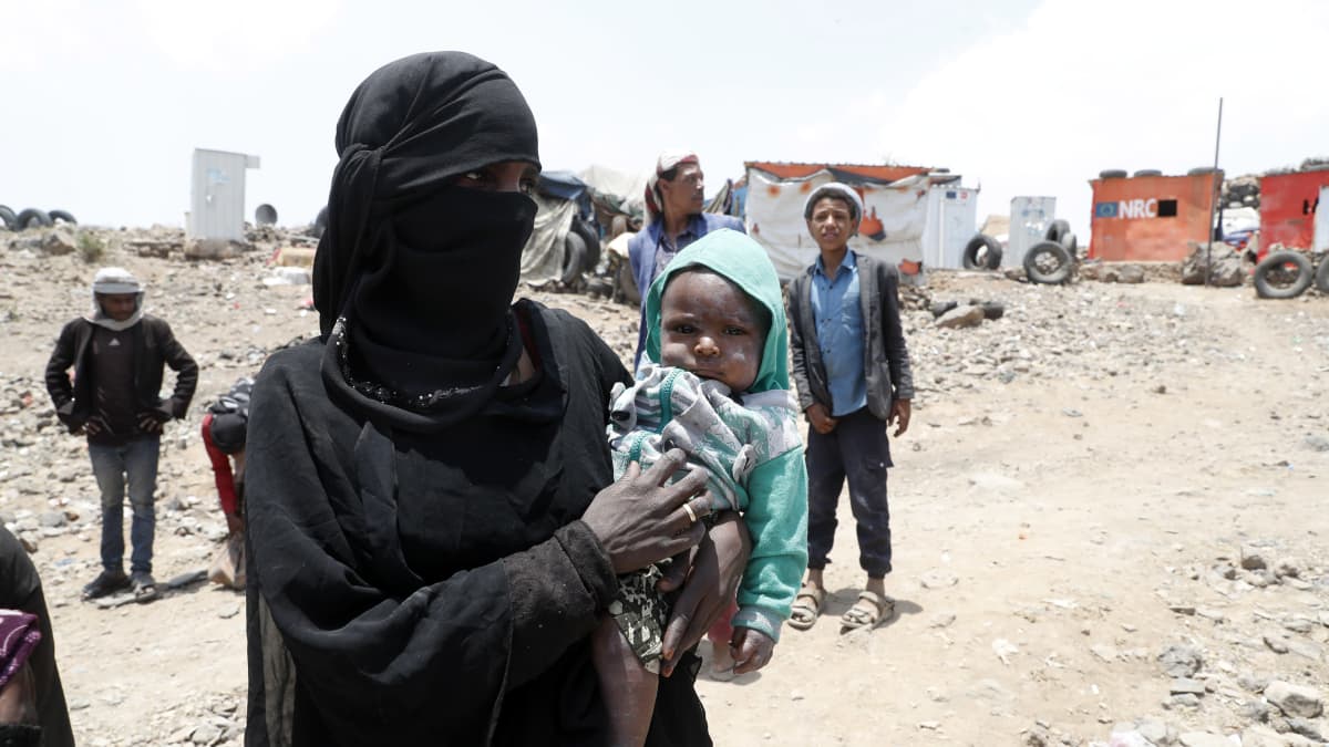 Jemeniläinen äiti pitää sylissään lastaan pakolaisleirillä Sanaan kaupungin ulkopuolella.