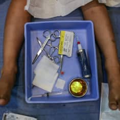 Potilas makaa vuoteella. Potilaan jalkojen välistä löytyy laatikko missä on leikkaukseen tarvittavia työkaluja.