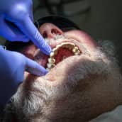Hammaslääkäri tarkistaa sormillaan potilaan hampaita.