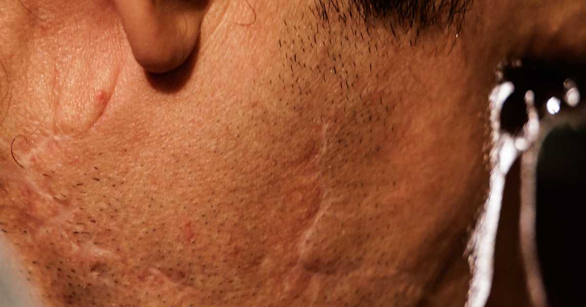 Kari ja naapuri joivat aamukahvit tavalliseen tapaan – pian naapuri viilsi hänen kurkkunsa auki