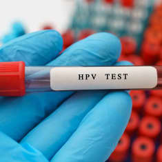 Putkilo, jonka päällä on teksti "HPV test".