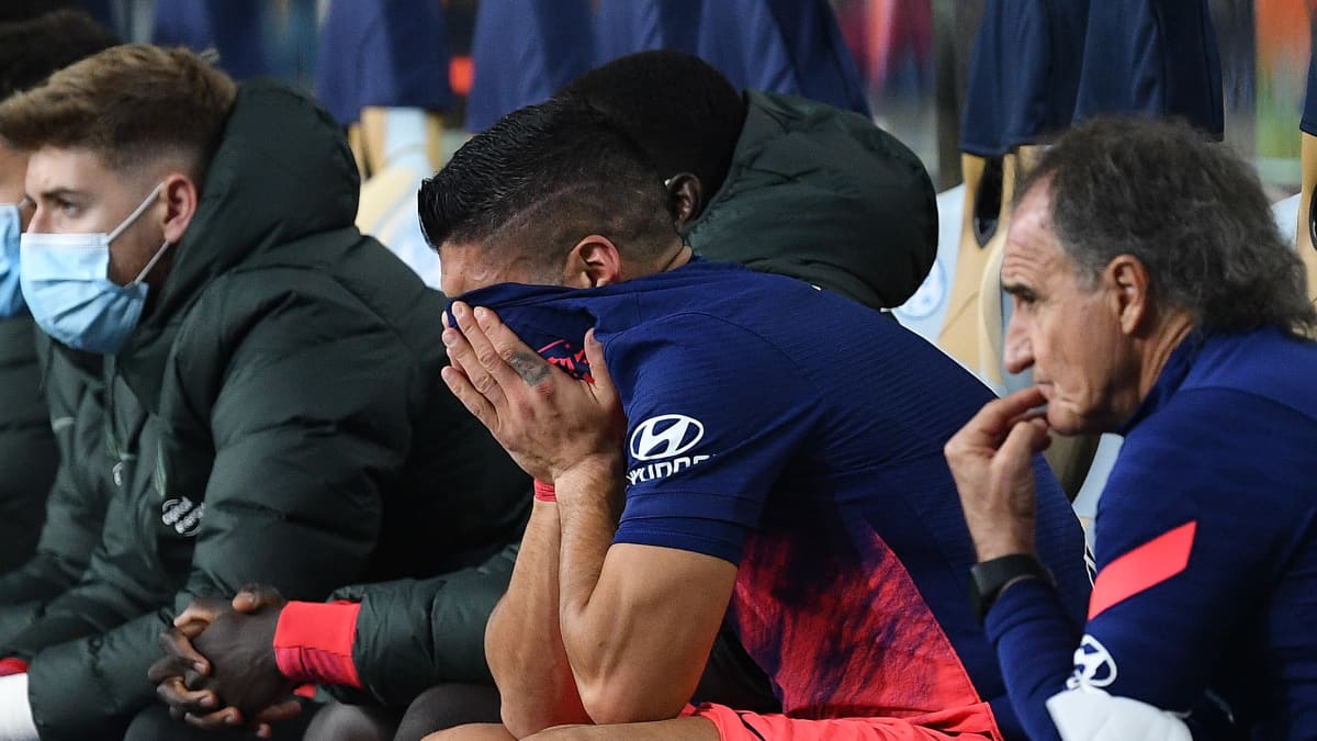 Luis Suarez peitti kasvonsa. Mestarien liigan lohkovaiheen päätöspeli oli päättynyt loukkaantumiseen.