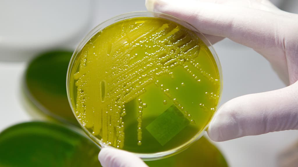 Laboratoriotyöntekijä vertailee keltavihreitä EHEC-bakteeripesäkkäitä petrimaljoissa.