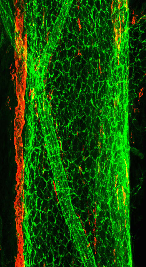 Kuvassa aivoveriviemäreihin (vihreä) lomassa kulkeva yksittäinen imusuoni (punainen).