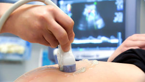 Ultraäänitutkimusta tehdään raskaana olevalle naiselle.