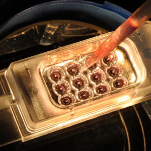 Embryon vid en klinik i Lepzig 2011
