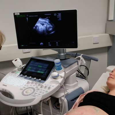 Äiti ultraäänitutkimuksessa.