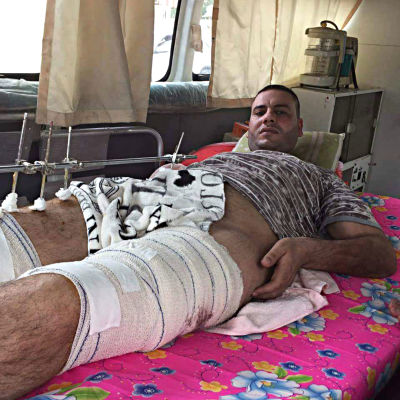 Mohammed Manteer på sjukhus i Bagdad.