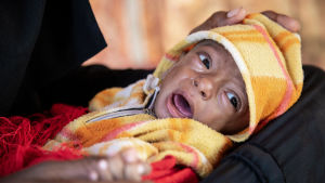 Åtta månader gamla Nabil är kraftigt undernärd och väger bara 4 kg. Baby Nabil, 8 månder gammal