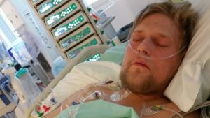 I samband med hjärttransplantationen var Mikael kopplad till apparater med en massa slangar. Mikael Kock ligger i en säng med slangar i kroppen.