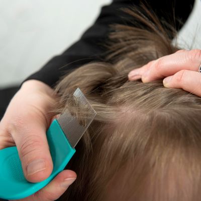 lapselta tutkitaan täitä hiuksista