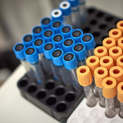 laboratorion näyteputkia